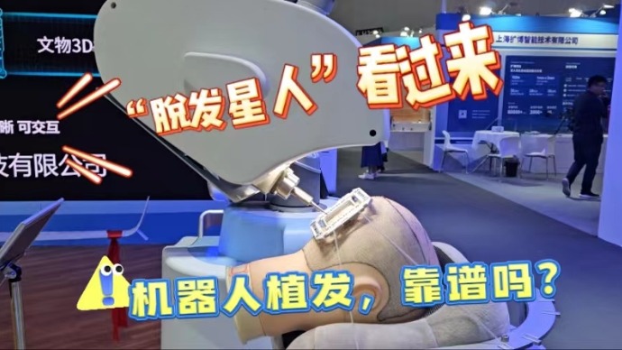 拯救你的脱发焦虑， 机器人植发到底靠不靠谱，点开视频看看吧！